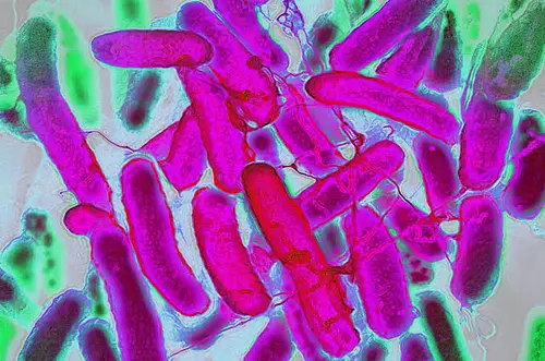 OMS advierte aumento global de bacterias resistentes