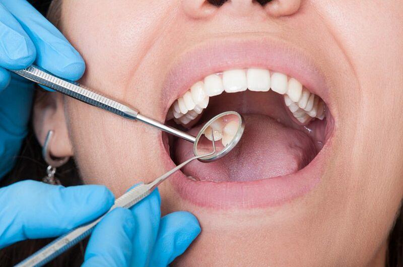 Caries, bruxismo y periodontitis en aumento