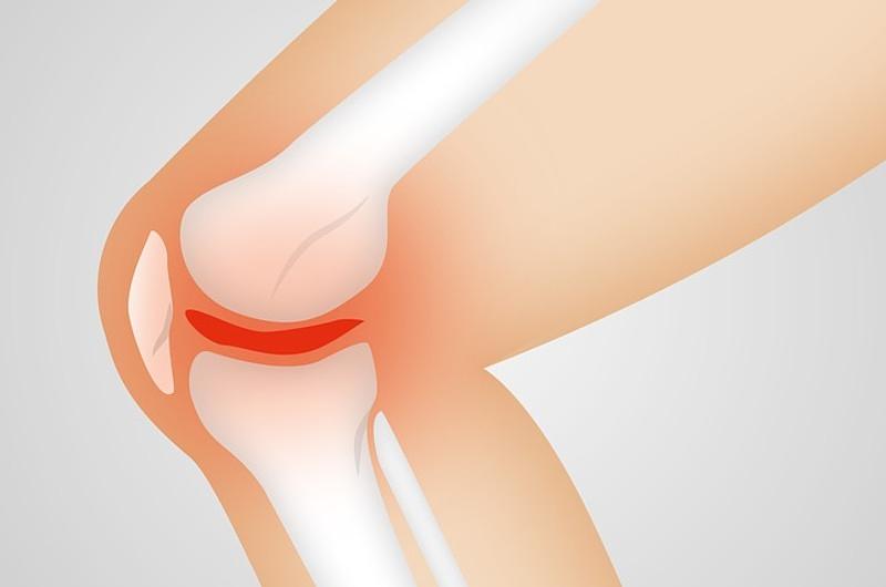 ¿Cómo regenerar el cartílago de la rodilla naturalmente?