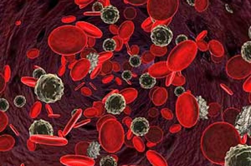 Conozca la Mielofibrosis: cuando las células sanguíneas no son suficientes