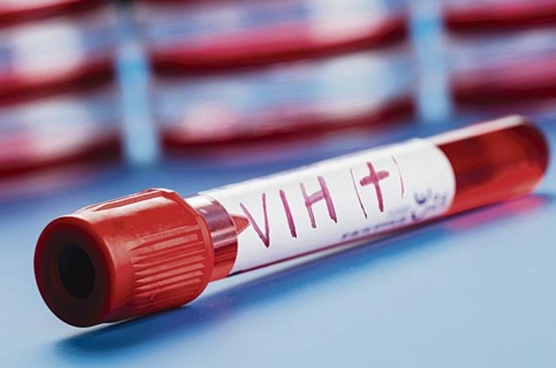 Insumo médico que detecta el VIH podría estar dando diagnósticos imprecisos